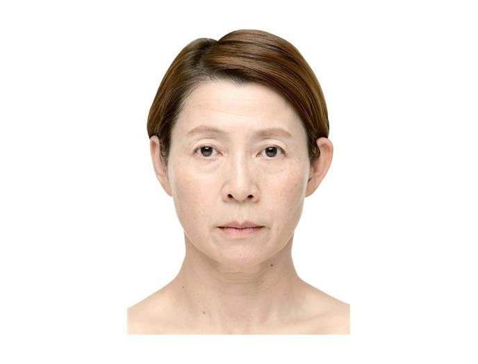 薬用リンクルクイック