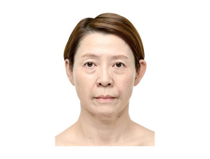 薬用リンクルクイック