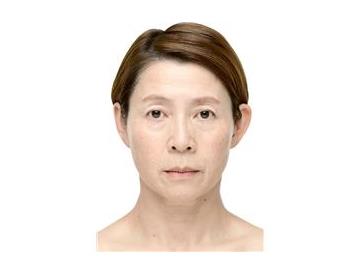 薬用リンクルクイック