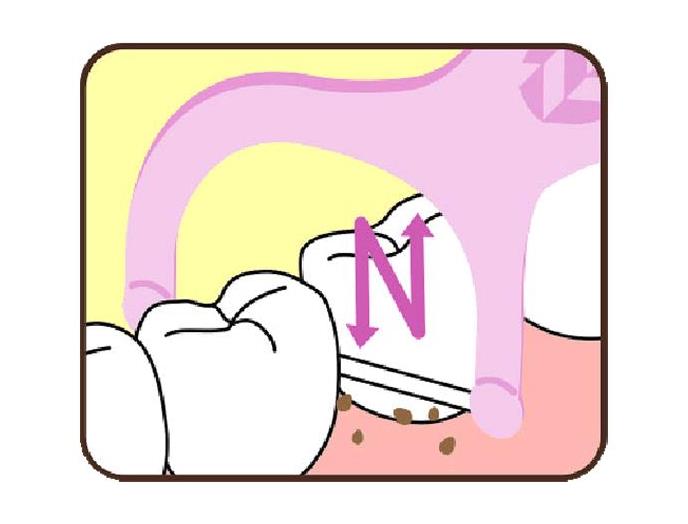 eやさしい入りやすいフロス